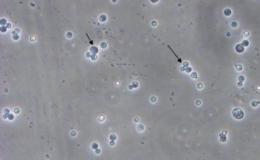 酵母双杂交技术原理、试验流程、特点以及应用