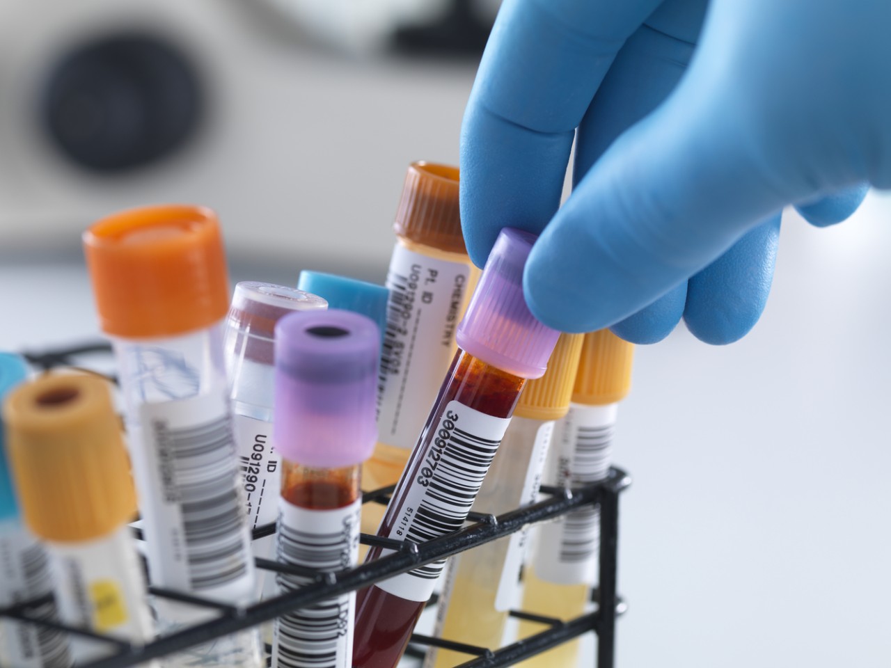 一致性评价大幕开启，医院市场即将调整