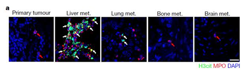 转入小鼠模型得到相同的试验结果，且在转移发生前NET已在肝脏聚积。