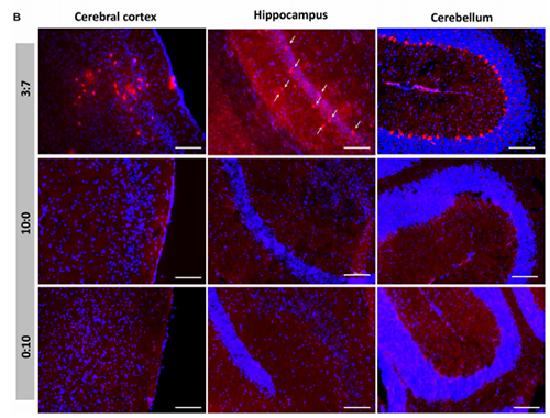 被包裹在含有NT-类脂质的LNP中的Cre重组酶成功转移。大脑中的转染神经元呈红色高亮。