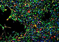 世界首创：药物将干细胞引导至受损部位，提高其愈合能力！