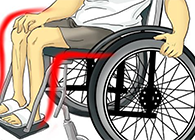 Nature：还瘫痪患者一个自由身的日子不远了