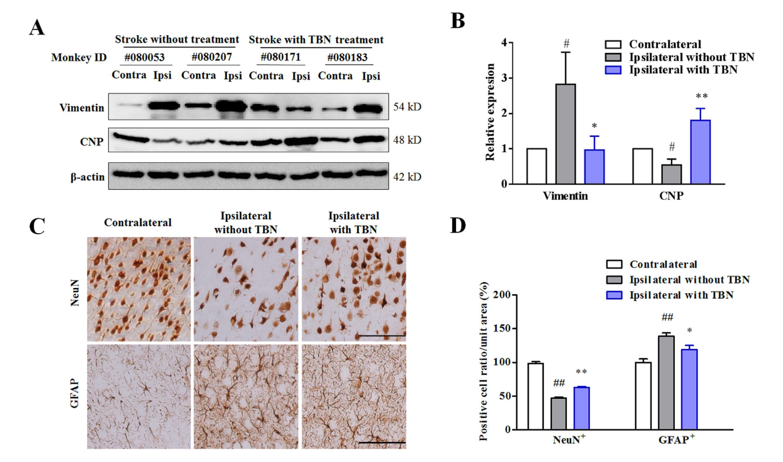 TBN是一种治疗缺血性卒中的新型临床候选药物，本研究中TBN通过HJC黄金城平台合成